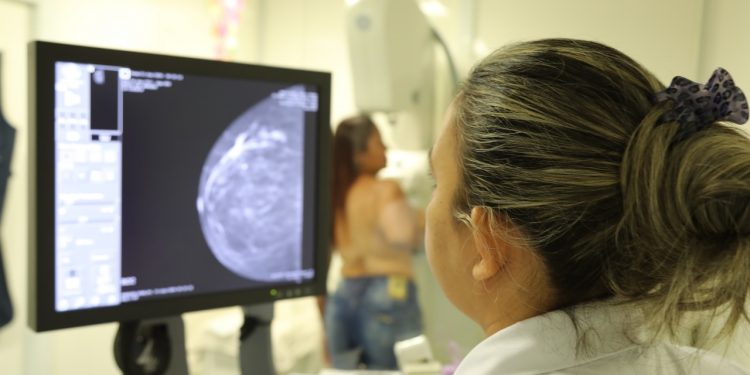 Parceria entre a prefeitura de Jaru e o Hospital de Amor garante realização gratuita de mamografias a mulheres jaruenses; atendimentos acontecem de 20 a 24 de janeiro