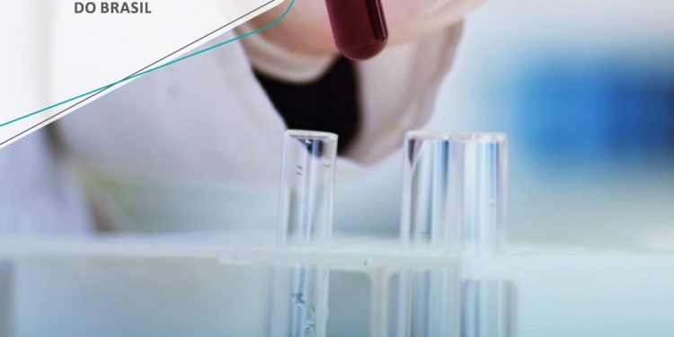 PREGÃO ELETRÔNICO Nº 158/PMJ/2020