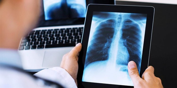 PREGÃO ELETRÔNICO N° 145/PMJ/2020