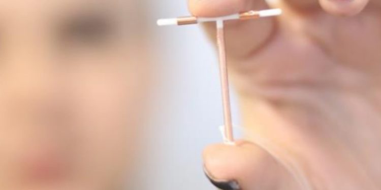 Secretaria de Saúde de Jaru oferece serviço de implantação de DIU para mulheres em idade fértil