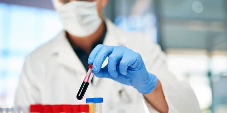 Confira quais são os laboratórios que realizam exames pelo SUS em Jaru