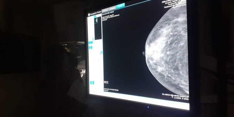 Prefeitura de Jaru realizará cadastro para exames de mamografia no distrito de Tarilândia nos dias 15 e 16 de dezembro 