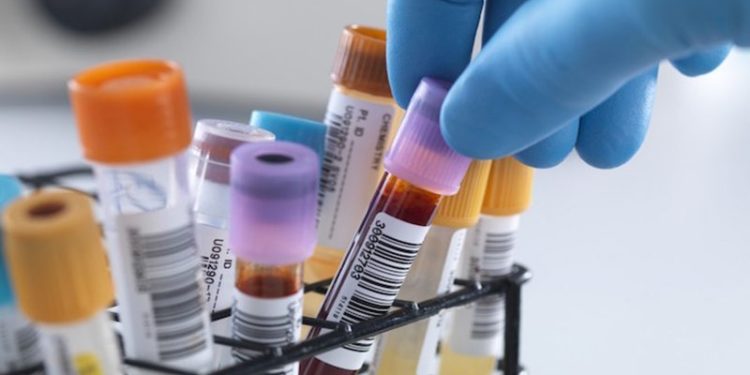 Laboratórios credenciados pela prefeitura de Jaru realizaram cerca de 17 mil exames nos meses de dezembro e janeiro