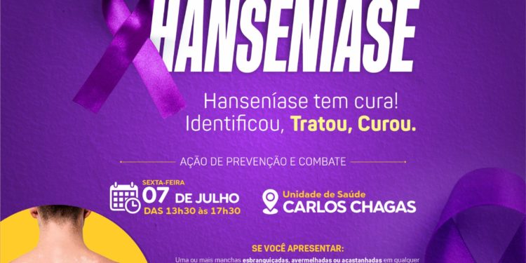 Secretaria de Saúde Jaru promoverá ação de prevenção e combate a Hanseníase no dia 07 de julho