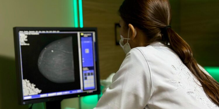 Prevenção: Mais de 600 procedimentos foram realizados durante atendimentos da Unidade Móvel do Hospital do Amor em Jaru; ação aconteceu em parceria com a Prefeitura e OAB