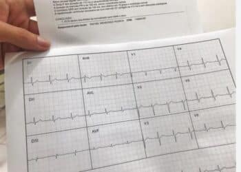 PREGÃO ELETRÔNICO Nº 030/PMJ/2025