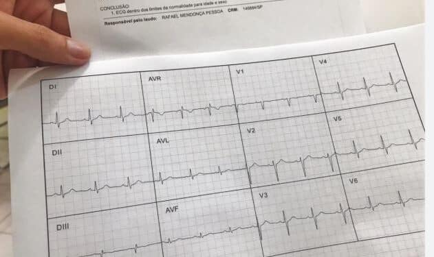PREGÃO ELETRÔNICO Nº 030/PMJ/2025