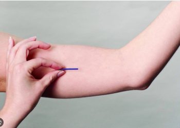 AVISO DE LICITAÇÃO PREGÃO ELETRÔNICO Nº 100/PMJ/2025